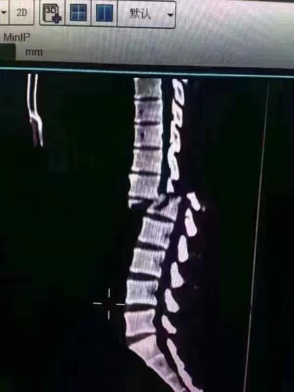 小房间缺氧_健身房运动缺氧_心房缺氧